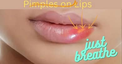 pimples on lips