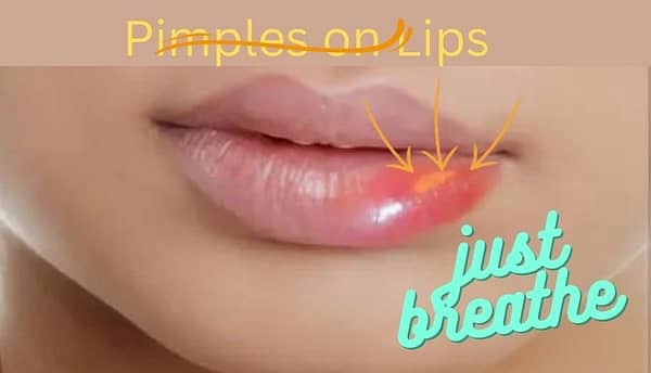 pimples on lips